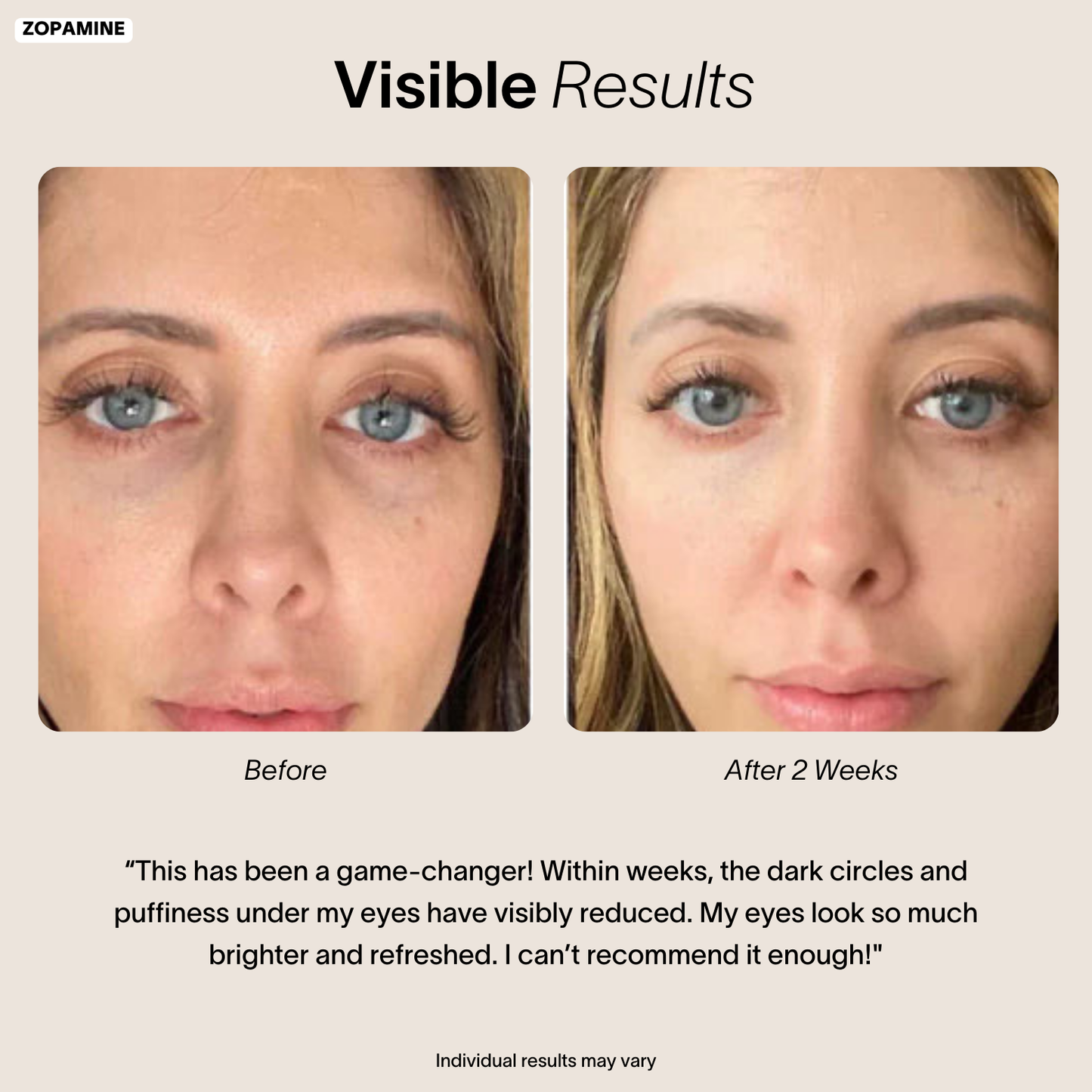 Transform Your Under Eye Skin in Just 2 Weeks with Red Light Therapy Under-Eye Massage Glasses
